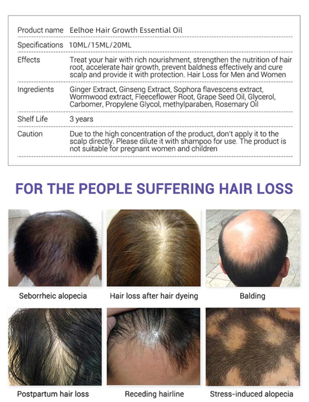 Eelhoe 7 Days Ginger Hair Restorer Essential Oil